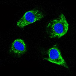 Immunofluorescence analysis of SKOV-3 cells at 1/100