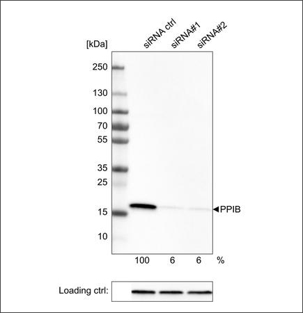 Genetic validation by siRNA knock down in WB using the Anti-PPIB antibody. U-251 cells have been transfected with control siRNA and two target specific siRNA probes. Downregulation of antibody signal confirms target specificity. The remaining intensity relative to the control lane is indicated as a percentage.