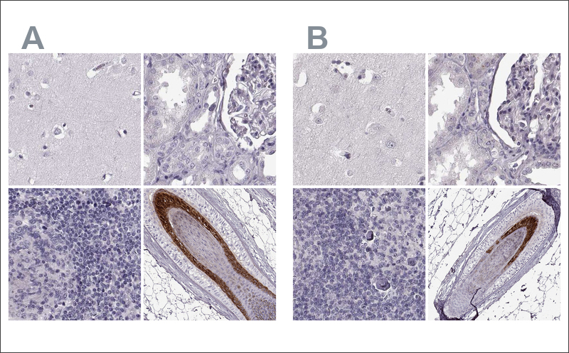 IHC stainings of two Anti -TCHHL1 antibodies HPA063483 (A) and HPA042579 (B) in cerebral cortex, kidney, lymph node and skin. These two antibodies target different regions of TCHHL1. Antibody stainings across relevant positive and negativetissues are similar between the two antibodies so they validate each other. 