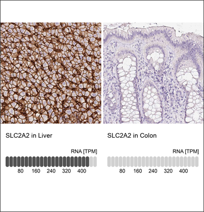 IHC staining of liver and colon tissues using Anti-SLC2A2 antibody (HPA028997). The corresponding RNA-Seq data (TPM values) for the same tissues are presented below.