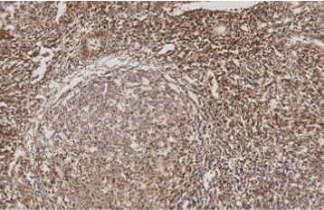 Non-Specific Staining in IHC