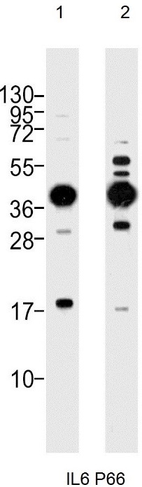 Western blot analysis of: (1) HeLa whole cell lysate, (2) A549 whole cell lysate at 1/1000.