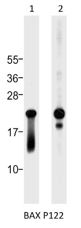 Western blot analysis of:- (1) A549 whole cell lysate  (2) Daudi whole cell lysate