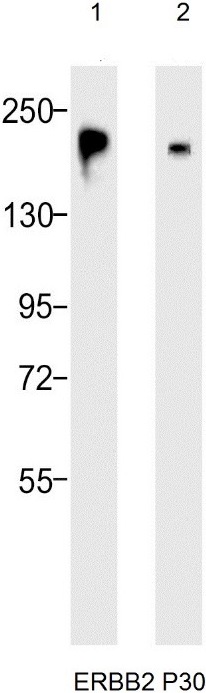 Western blot analysis of: (1) SK-BR-3 whole cell lysate (2) MCF-7 whole cell lysate using anti-ERBB2 70R-12085 antibody (see Method for primary and secondary antibody details).