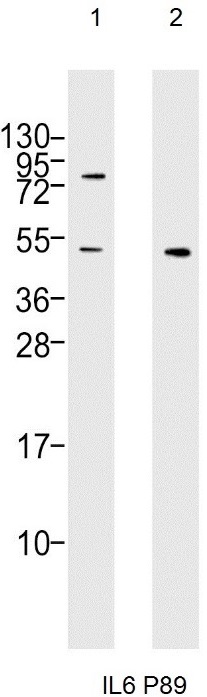 Western blot analysis of: (1) HeLa whole cell lysate, (2) A549 whole cell lysate at 1/1000.