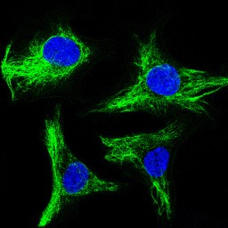 Immunofluorescence analysis of SKOV-3 cells at 1/100