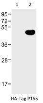 Western blot analysis of:- (1) 293T/17 whole cell lysate (2) HA-Tag transfected 293T/17 whole cell lysate