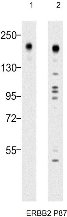 Western blot analysis of: (1) SK-BR-3 whole cell lysate (2) MCF-7 whole cell lysate using anti-ERBB2 sc-284 antibody (see Method for primary and secondary antibody details).