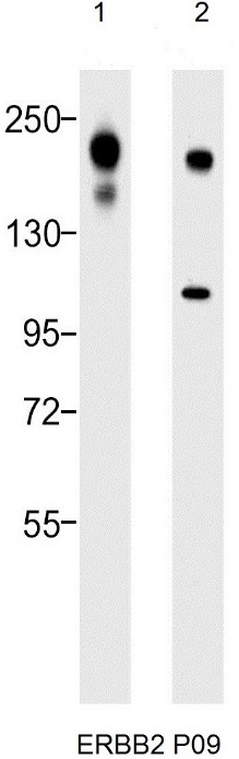 Western blot analysis of: (1) SK-BR-3 whole cell lysate (2) MCF-7 whole cell lysate using anti-ERBB2 HPA001383 antibody (see Method for primary and secondary antibody details).