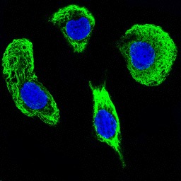 Immunofluorescence analysis of SKOV-3 cells at 1/500